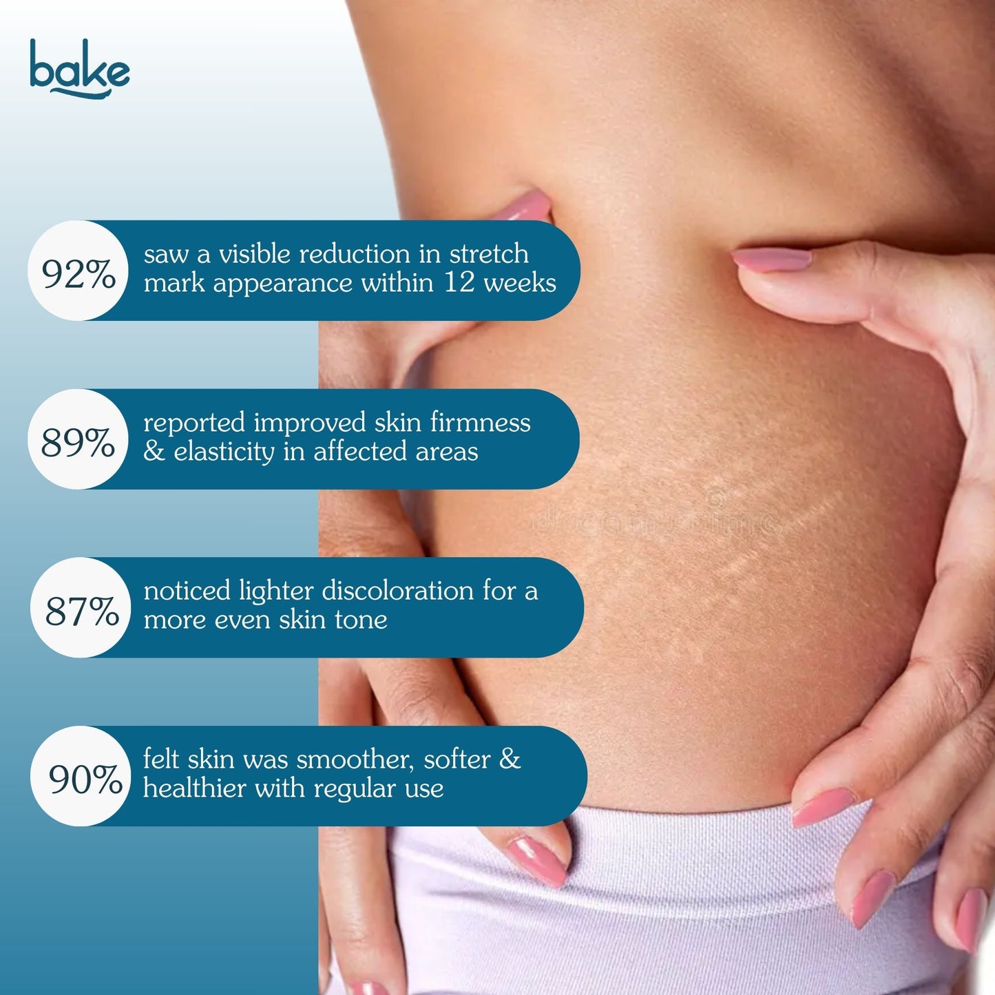 StriErase™ Stretch Marks Removal Roll On Serum