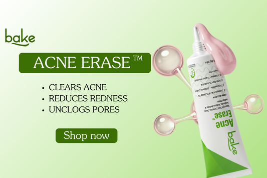 Acne Erase Overnight Spot Corrector | Clear Breakouts Fast | Bake Cosmetics