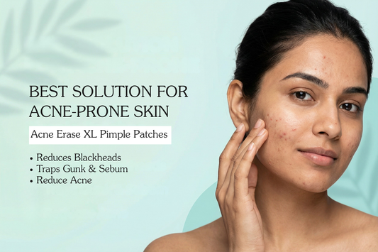 Acne Erase XL Pimple Patches – 10 Strips: Overnight Care for Large Breakouts