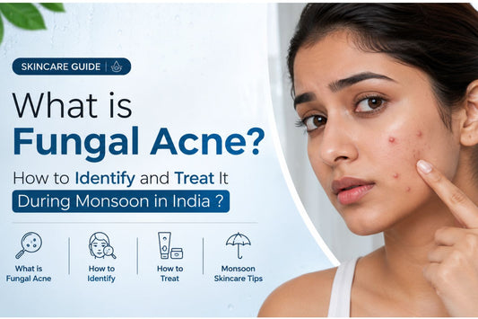 What is Fungal Acne? How to Identify and Treat It During Monsoon in India?