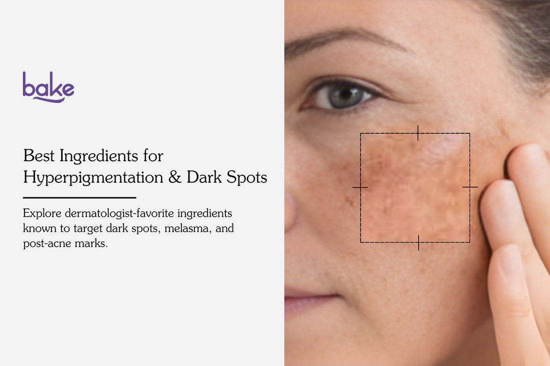 Top 10 Ingredients That Dermatologists Recommend for Pigmentation in India (2026)
