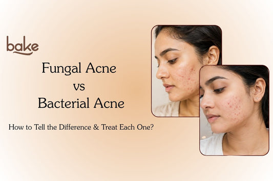 Fungal Acne vs Bacterial Acne: How to Tell the Difference in Monsoon?