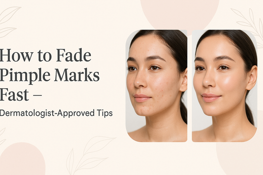 How to Fade Pimple Marks Fast – Dermatologist-Approved Tips