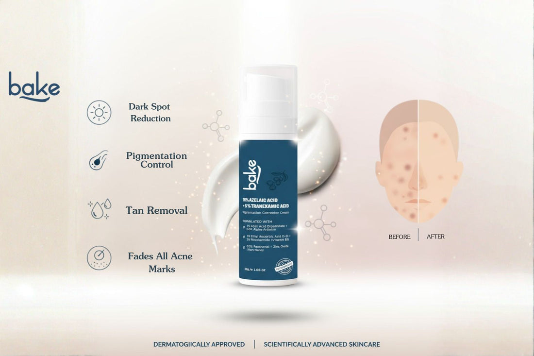 BAKE 10% Azelaic Acid + 5% Tranexamic Acid Pigmentation Corrector Cream: Your All-in-One Solution for Dark Spots, Pigmentation & Tan Removal
