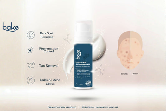 BAKE 10% Azelaic Acid + 5% Tranexamic Acid Pigmentation Corrector Cream: Your All-in-One Solution for Dark Spots, Pigmentation & Tan Removal