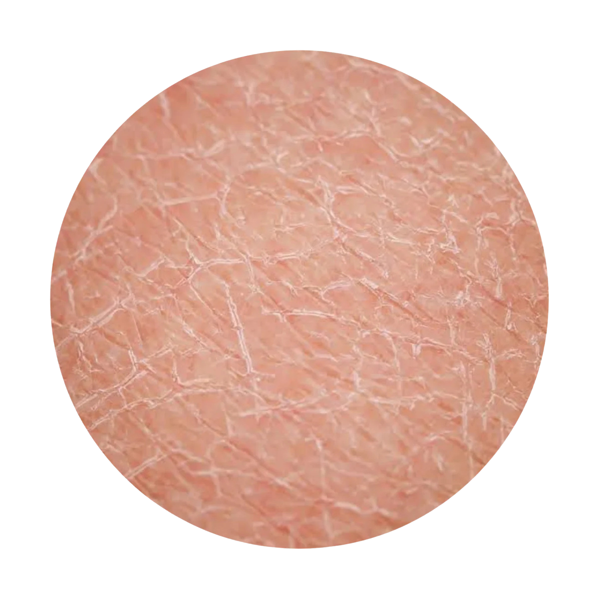 Rough & Blemished Skin