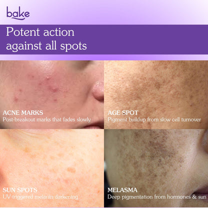 Spot Erase Dark Spot Correcting Serum