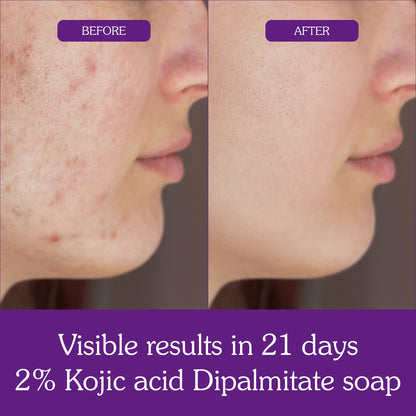2% Kojic Acid + Turmeric Soap with Niacinamide (Pack of 2)