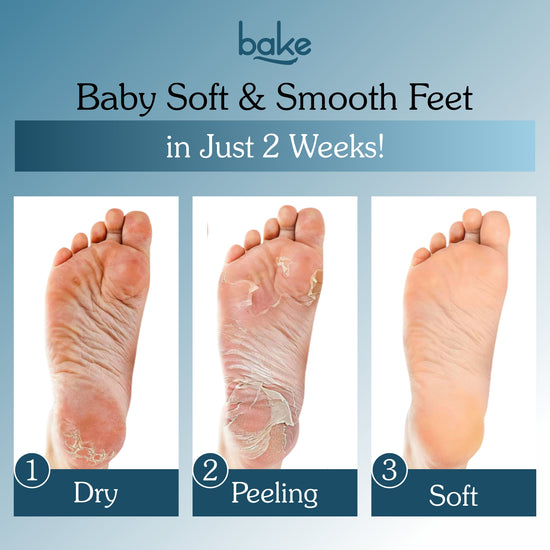 Peel Away Dead Skin in 7 Days — AHA + BHA Exfoliating Foot Mask