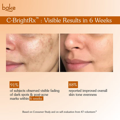 Before and after results of Bakve C-BrightRx Vitamin C brightening cream showing reduced dark spots and improved skin tone in 6 weeks