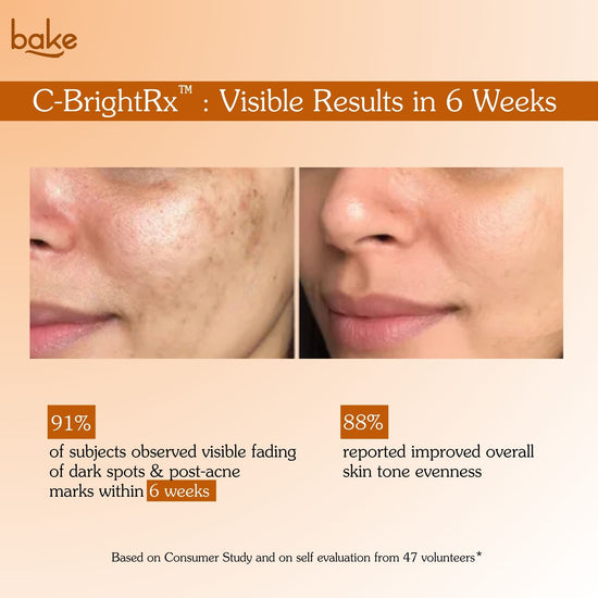 Before and after results of Bakve C-BrightRx Vitamin C brightening cream showing reduced dark spots and improved skin tone in 6 weeks