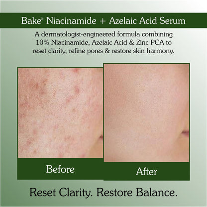 10% Niacinamide + Azelaic Acid Clarifying Serum