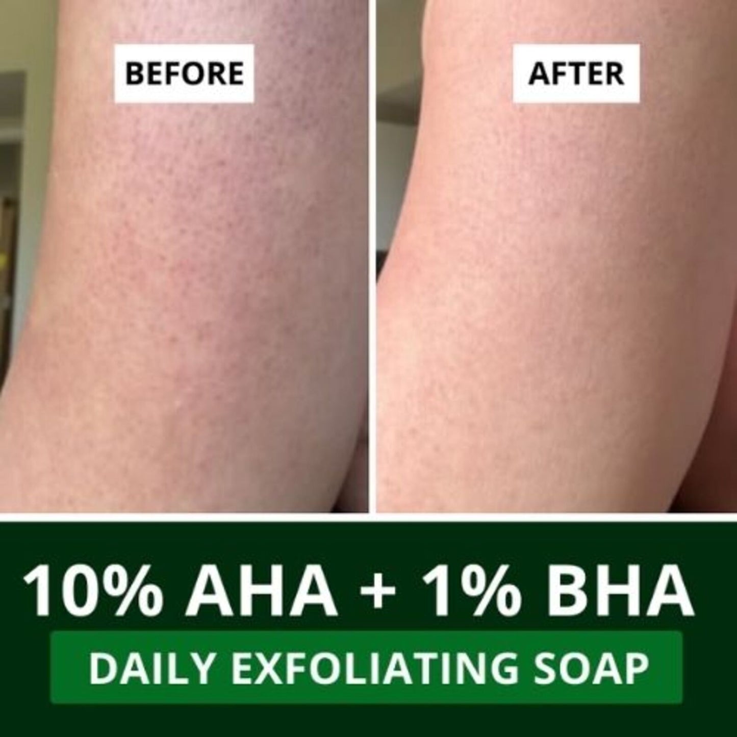 10% AHA + 1% BHA Scrub Treatment Soap