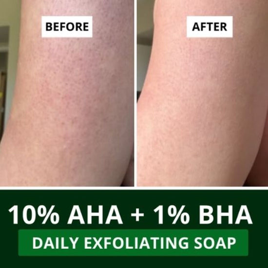 10% AHA + 1% BHA Scrub Treatment Soap (Pack of 3, 300g)