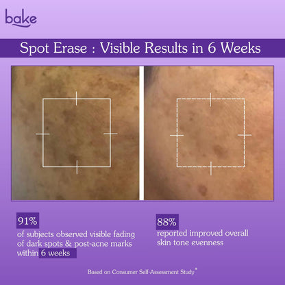 Spot Erase Dark Spot Correcting Serum