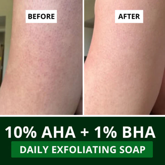 10% AHA + 1% BHA Scrub Treatment Soap