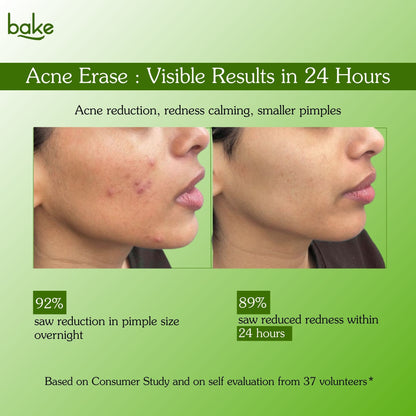 Acne Erase Overnight Spot Corrector Cream