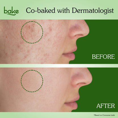 Acne Control Face Wash & Body Soap Combo