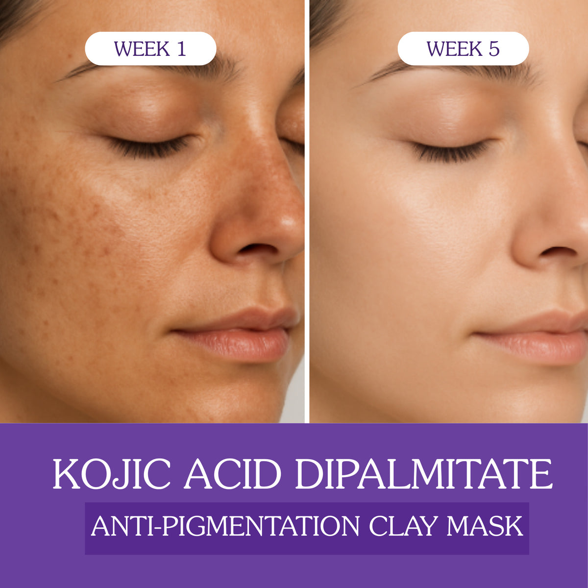 Variant- Kojic Acid Clay mask