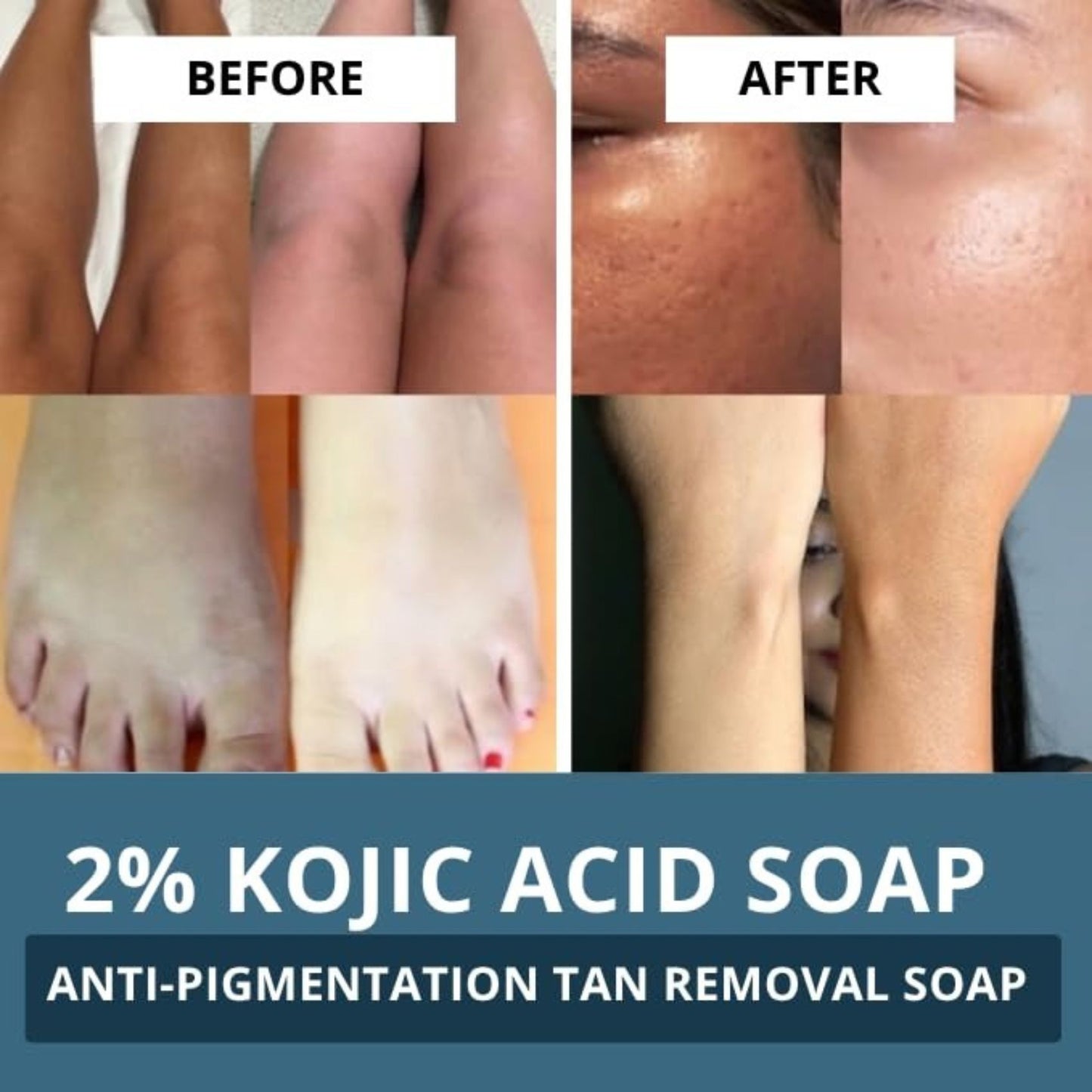 2% Kojic Acid Alpha Arbutin Face Wash & Soap Combo