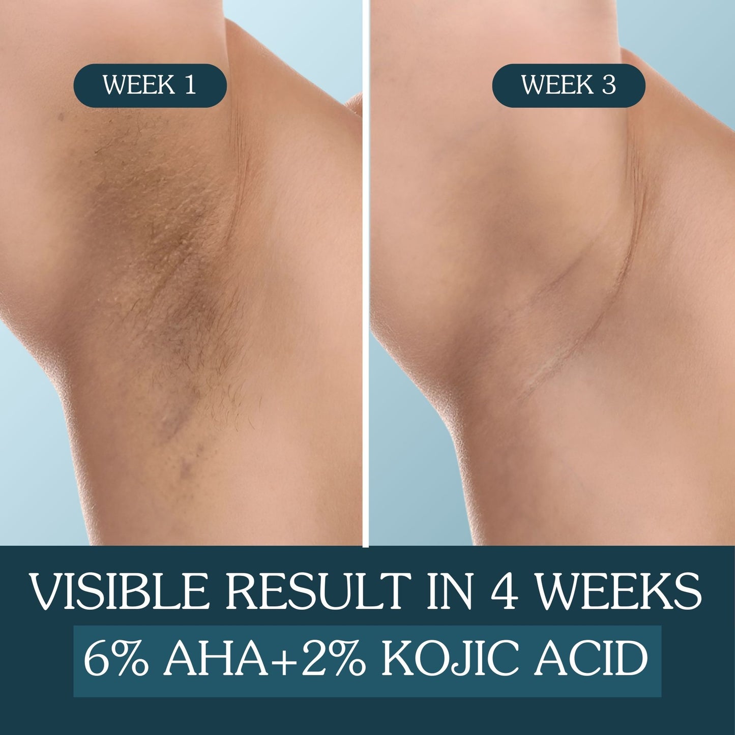BrightErase™ AHA Underarm Brightening & Exfoliating Serum Roll-On