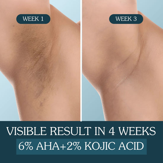 BrightErase™ AHA Underarm Brightening & Exfoliating Serum Roll-On