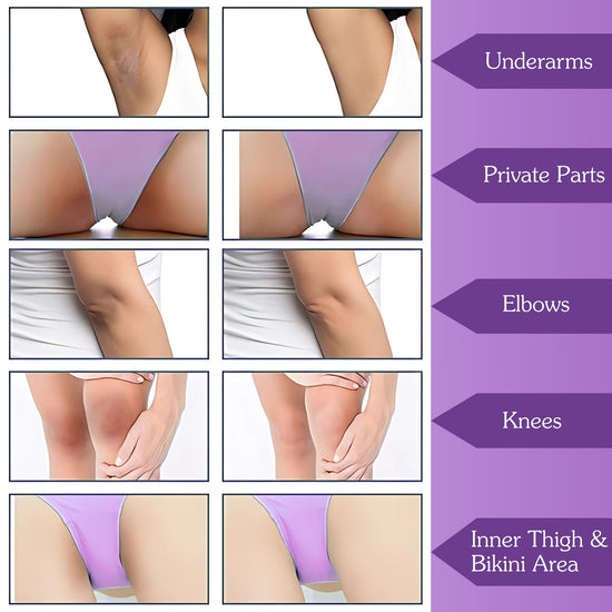 IntiErase™ Intimate Brightening Roll On Serum